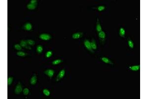 Immunofluorescent analysis of Hela cells using ABIN7150201 at dilution of 1:100 and Alexa Fluor 488-congugated AffiniPure Goat Anti-Rabbit IgG(H+L) (MLH1 antibody  (AA 350-519))