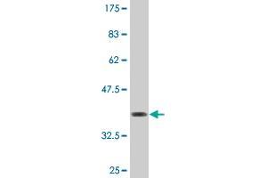 Western Blot detection against Immunogen (36. (OTUD7B antibody  (AA 759-858))