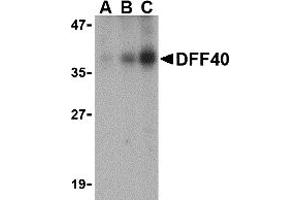 Western Blotting (WB) image for anti-DNA Fragmentation Factor, 40kDa, beta Polypeptide (Caspase-Activated DNase) (DFFB) (Middle Region) antibody (ABIN1030919) (DFFB antibody  (Middle Region))