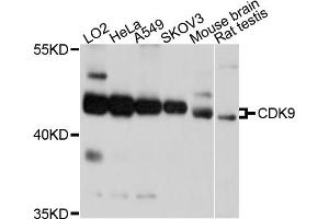 Western blot analysis of extracts of various cell lines, using CDK9 antibody (ABIN5995939) at 1/1000 dilution. (CDK9 antibody)