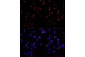 Immunofluorescence analysis of C6 cells using GOLG antibody (ABIN7267496) at dilution of 1:100. (GOLGA5 antibody  (AA 1-300))