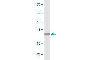 Western Blot detection against Immunogen (36. (CBS antibody  (AA 1-100))