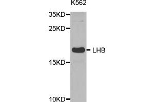 Western blot analysis of extracts of K-562 cells, using LHB antibody (ABIN5971542) at 1:400 dilution.