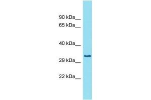 Host: Rabbit Target Name: FAM26E Sample Type: Fetal Lung lysates Antibody Dilution: 1. (FAM26E antibody  (Middle Region))