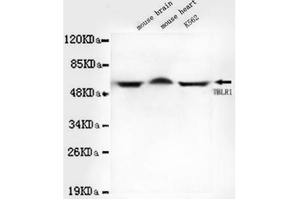 TBL1XR1 anticorps
