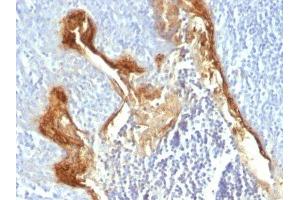 Image no. 1 for anti-Involucrin (IVL) antibody (ABIN6164814) (Involucrin antibody)
