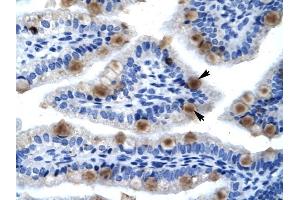 MCM6 antibody was used for immunohistochemistry at a concentration of 4-8 ug/ml to stain Epithelial cells of intestinal villus (lndicated with Arrows) in Human Intestine. (MCM6 antibody  (C-Term))