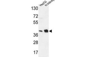 Western Blotting (WB) image for anti-NADH Dehydrogenase (Ubiquinone) 1 alpha Subcomplex, 10, 42kDa (NDUFA10) antibody (ABIN3004309)