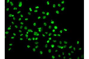 Immunofluorescence analysis of MCF-7 cells using HMG20A antibody (ABIN5974388). (HMG20A antibody)