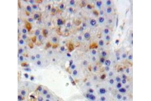 Used in DAB staining on fromalin fixed paraffin-embedded Liver tissue (LDLR antibody  (AA 497-742))