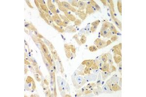 Immunohistochemistry of paraffin-embedded mouse heart using PCBP2 antibody. (PCBP2 antibody)