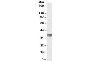 Western blot testing of human testis lysate with FBXO4 antibody at 0.