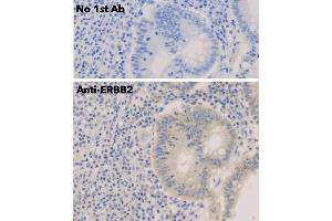 Immunohistochemistry (IHC) image for anti-Receptor tyrosine-protein kinase erbB-2 (ErbB2/Her2) (C-Term) antibody (ABIN6254225)