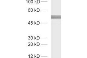 dilution: 1 : 1000, sample: rat brain homogenate (PACSIN1 antibody  (AA 293-384))