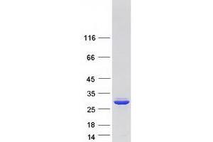 C16ORF13 Protein (Transcript Variant 1) (Myc-DYKDDDDK Tag)