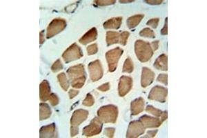 Immunohistochemistry analysis in formalin fixed and paraffin embedded skeletal muscle reacted with PDK2 Antibody  followed by peroxidase conjugation of the secondary antibody and DAB staining. (PDK2 antibody)