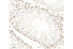 Immunohistochemistry (Paraffin-embedded Sections) (IHC (p)) image for anti-Polyglutamine Binding Protein 1 (PQBP1) antibody (ABIN7075126)