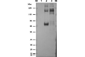 Western blot: anti-Spikeprotein M: Marker 1: (ABIN7538787) VLP_SARS-CoV-2 (M+E+N) 2: SARS-CoV-2 spikeprotein (Sino Biologicals 40589-V08B1) 3: (ABIN7538786) VLP_SARS-CoV-2 (S+M+E+N) 1°Antibody: C-0005-50UL Mouse anti-SARS-CoV-2 spike serum 1:5000 2°Antibody: Goat-anti-mouse-HRP (SARS-CoV-2 Spike-, Membrane-, Envelope-, Nucleoprotein protein-VLP)