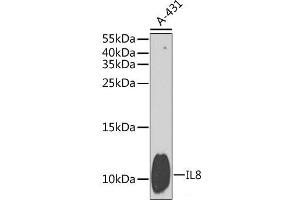 Western blot analysis of extracts of A-431 cells using IL8 Polyclonal Antibody at dilution of 1:1000. (IL-8 antibody)