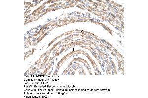 Rabbit Anti-CPSF6 Antibody  Paraffin Embedded Tissue: Human Muscle Cellular Data: Skeletal muscle cells Antibody Concentration: 16. (CPSF6 antibody  (Middle Region))