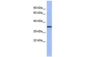 Image no. 1 for anti-Wingless-Type MMTV Integration Site Family, Member 4 (WNT4) (AA 143-192) antibody (ABIN6742254)