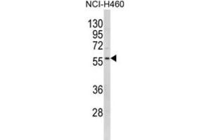 Western Blotting (WB) image for anti-Potassium Inwardly-Rectifying Channel, Subfamily J, Member 2 (KCNJ2) antibody (ABIN3002884) (KCNJ2 antibody)