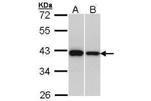 WB Image Sample (30 ug of whole cell lysate) A: H1299 B: Hep G2 , 12% SDS PAGE antibody diluted at 1:1000 (RAD51 antibody  (Center))