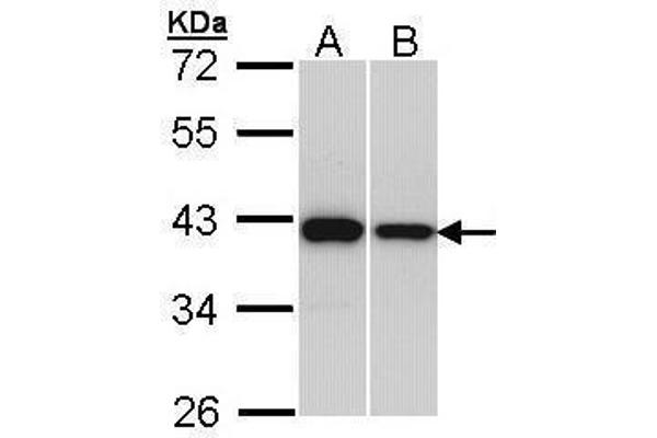 RAD51 antibody  (Center)