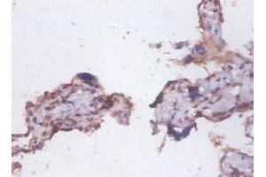 Immunohistochemistry of paraffin-embedded human placenta tissue using ABIN7173891 at dilution of 1:100 (FAS antibody  (AA 26-171))