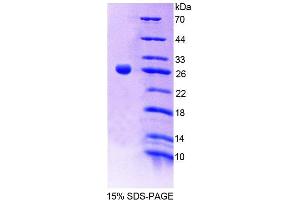 SDS-PAGE analysis of Mouse CNTN2 Protein.
