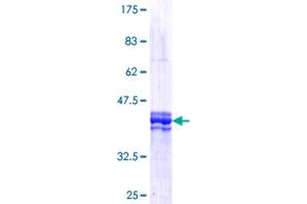 FOXM1 Protein (AA 702-801) (GST tag)