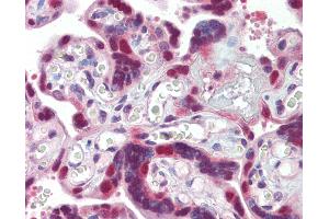 anti-DnaJ (Hsp40) Homolog, Subfamily B, Member 1 (DNAJB1) antibody