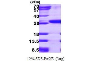 SDS-PAGE (SDS) image for Ethylmalonic Encephalopathy 1 (ETHE1) (AA 13-254) protein (His tag) (ABIN668013)