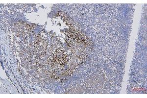IHC analysis of CD35 using anti-CD35 antibody (ABIN7599703).