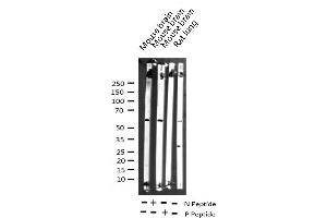 Western blot analysis of Phospho-Smad1 (Ser465) expression in various lysates (SMAD1 antibody  (pSer465))