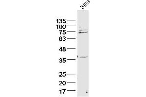 Siha lysates probed with Cytokeratin 2e Polyclonal Antibody, unconjugated  at 1:300 overnight at 4°C followed by a conjugated secondary antibody for 60 minutes at 37°C. (Keratin 2 antibody  (AA 251-350))