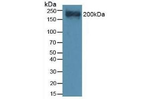 Detection of VCAN in Mouse Heart Tissue using Polyclonal Antibody to Versican (VCAN) (Versican antibody  (AA 3058-3299))