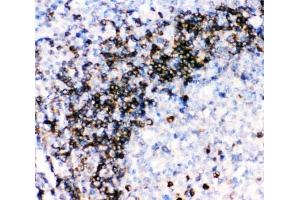 IHC-P: CD79a antibody testing of human tonsil tissue (CD79a antibody  (AA 121-226))