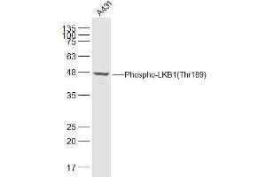 A431 lysates probed with LKB1(Thr189) Polyclonal Antibody, Unconjugated  at 1:500 dilution and 4˚C overnight incubation. (LKB1 antibody  (pThr189))