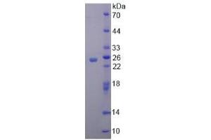 Image no. 1 for Leucine Rich Repeats And Death Domain Containing Protein (AA 694-885) protein (His tag) (ABIN4989366) (Leucine Rich Repeats And Death Domain Containing Protein (AA 694-885) protein (His tag))