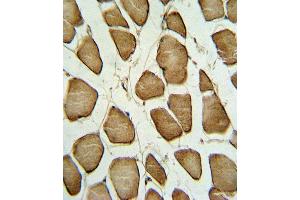 Formalin-fixed and paraffin-embedded human Skeletal muscle reacted with CAV3 Antibody (N-term), which was peroxidase-conjugated to the secondary antibody, followed by DAB staining. (Caveolin 3 antibody  (N-Term))