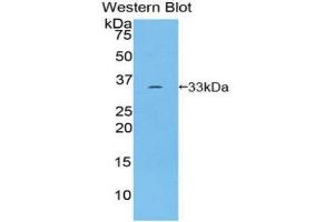 Western blot analysis of recombinant Human ROR1. (ROR1 antibody  (AA 540-795))