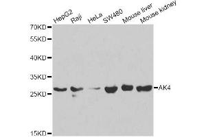 Western blot analysis of extracts of various cell lines, using AK4 antibody (ABIN5971082) at 1/1000 dilution. (AK4 antibody)