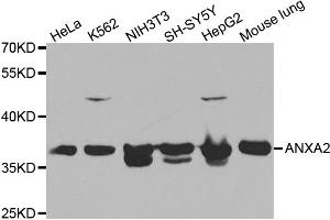 Western blot analysis of extracts of various cell lines, using ANXA2 antibody (ABIN5970753) at 1/1000 dilution. (Annexin A2 antibody)