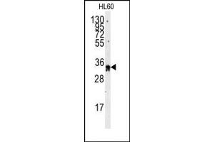 Image no. 1 for anti-Exosome Component 8 (EXOSC8) (C-Term) antibody (ABIN357948) (EXOSC8 antibody  (C-Term))