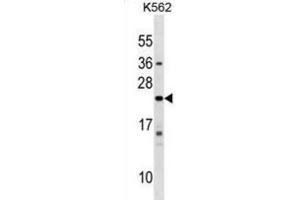 Western Blotting (WB) image for anti-Interferon, alpha 10 (IFNa10) antibody (ABIN2999555) (IFNA10 antibody)