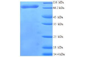 SDS-PAGE (SDS) image for Usher Syndrome 1C (Autosomal Recessive, Severe) (USH1C) (AA 1-533) protein (His-SUMO Tag) (ABIN4976236) (USH1C Protein (AA 1-533) (His-SUMO Tag))