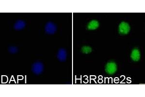 Immunofluorescence analysis of 293T cell using H3R8me2s antibody. (Histone 3 antibody  (H3R8me2s))