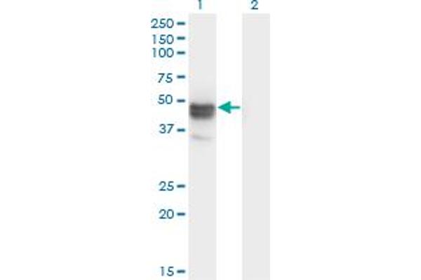 MAGEB1 antibody  (AA 86-195)