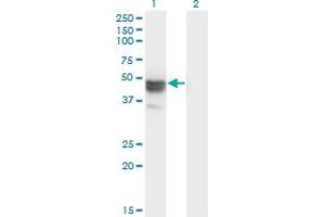 Western Blot analysis of MAGEB1 expression in transfected 293T cell line by MAGEB1 monoclonal antibody (M09), clone 3C1.